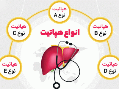 انواع هپاتیت و راه های انتقال آن را بشناسیم