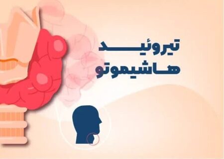 بیماری خاموشی که سلامت تیروئید را تهدید می‌کند