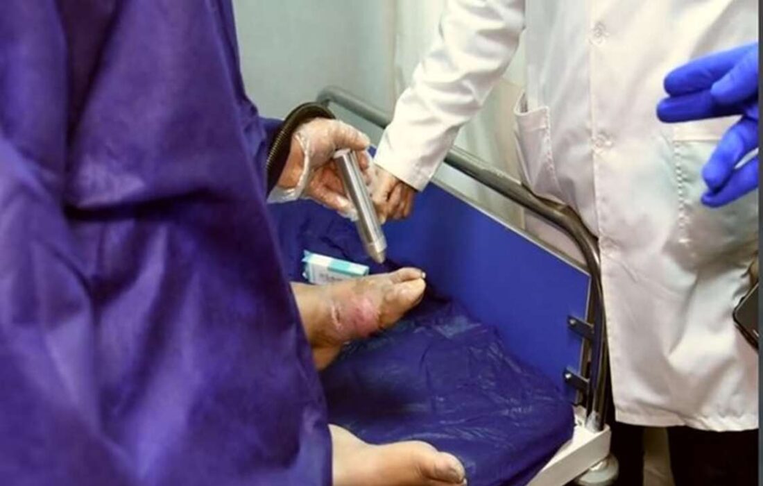 پلاسمادرمانی برای ۱۵۰۰ بیمار دیابتی در البرز