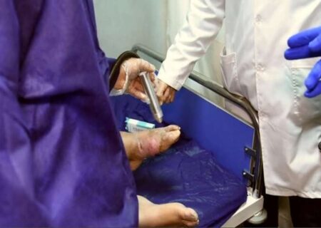 پلاسمادرمانی برای ۱۵۰۰ بیمار دیابتی در البرز