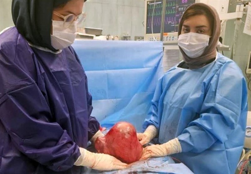 توده سارکوم رحم از شکم یک بانوی 45 ساله خارج شد